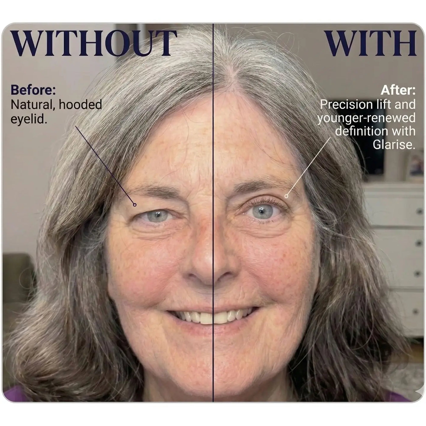 Front view of the GLARISE Corrective Eyelid Strips package and applicator