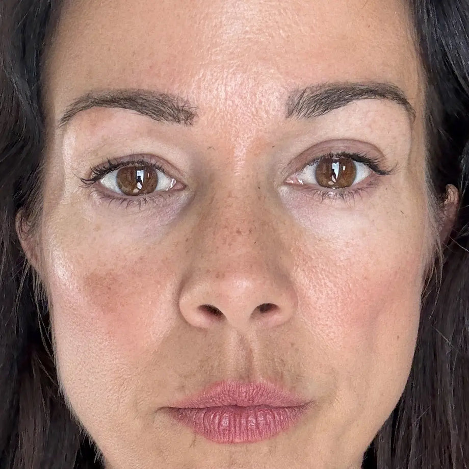 Colleen before and after using GLARISE eyelid strips